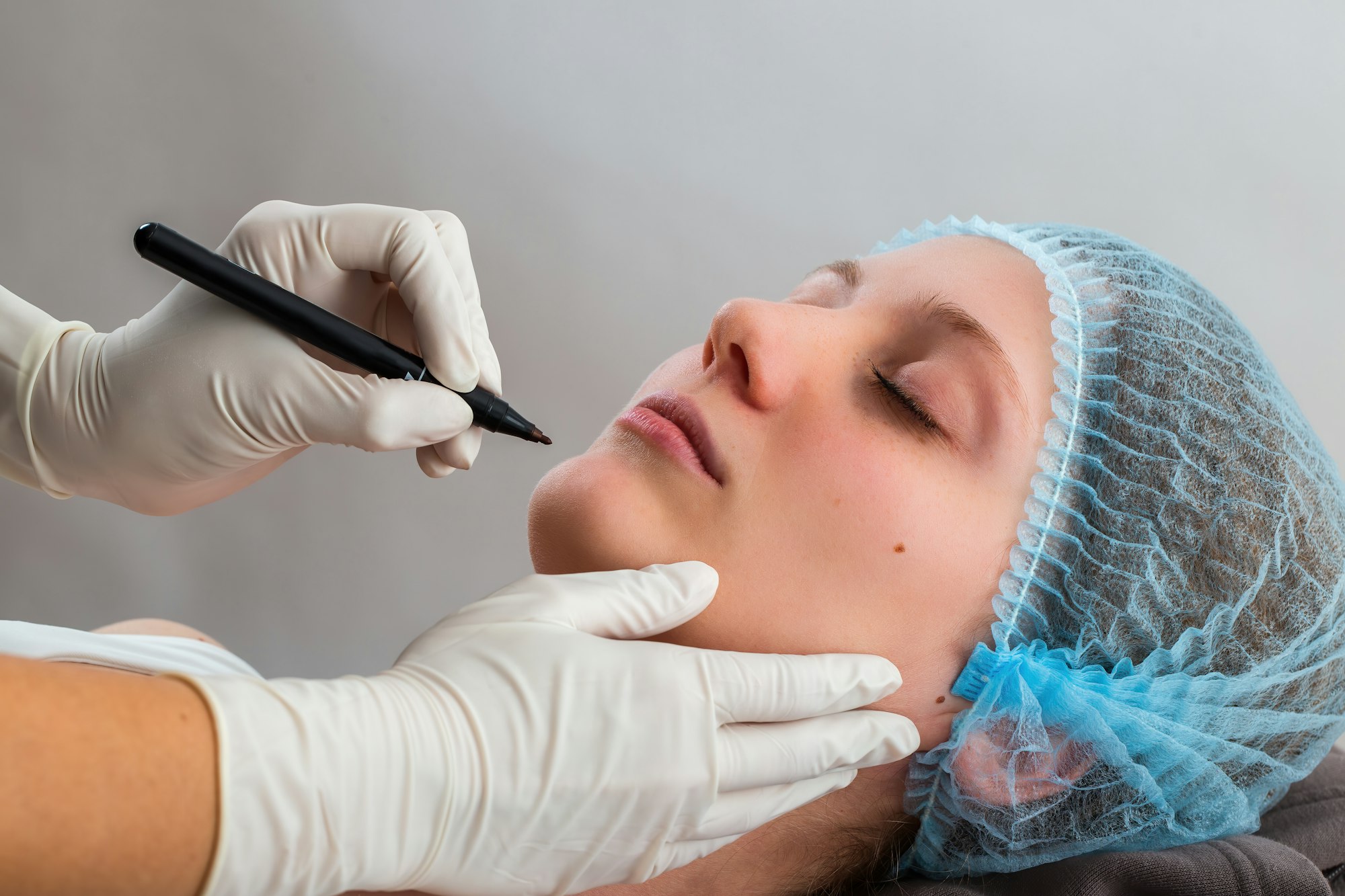 Hands in gloves marking procedure before plastic surgery